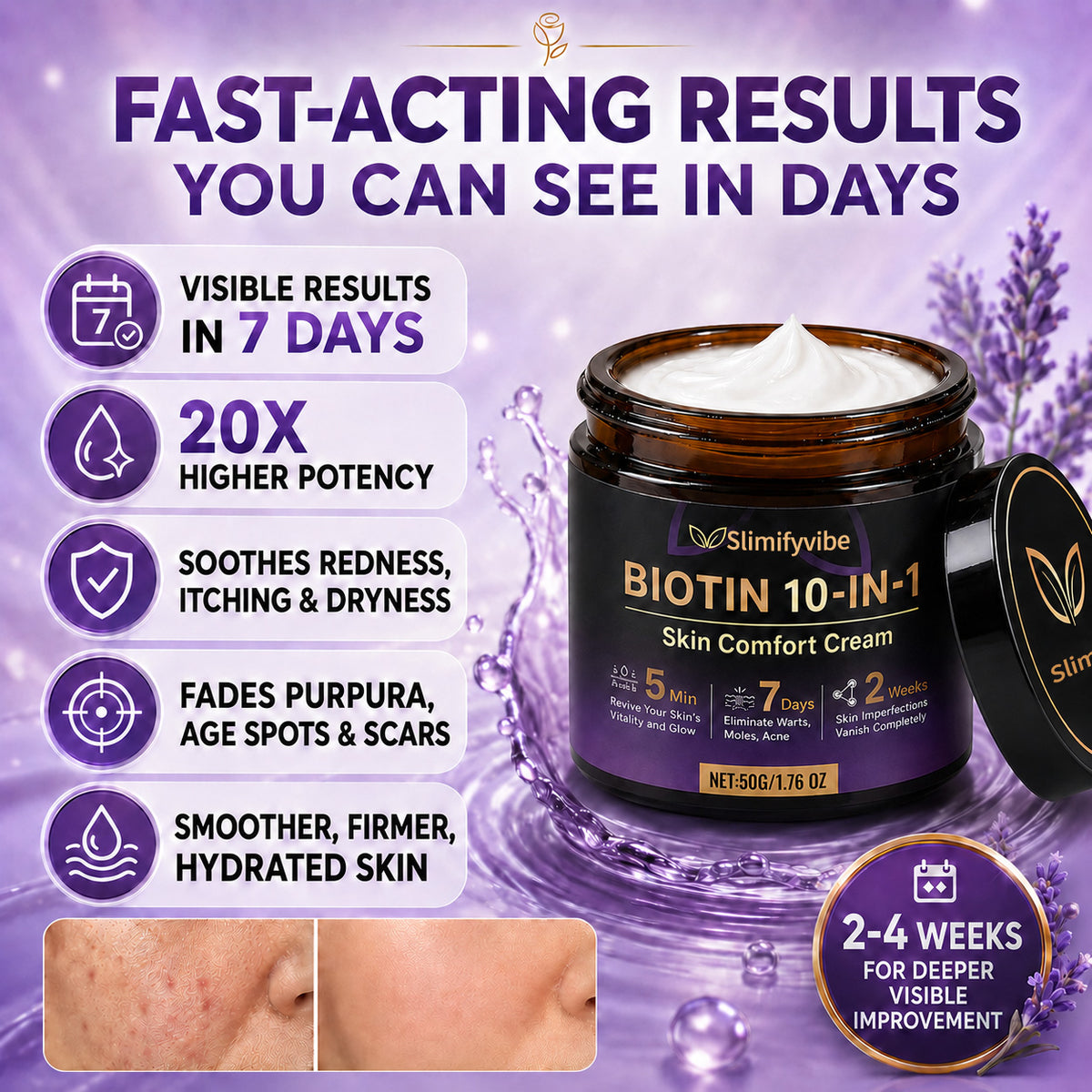 ✨Slimifyvibe® Biotin 10-in-1 Skin Comfort Cream🍀