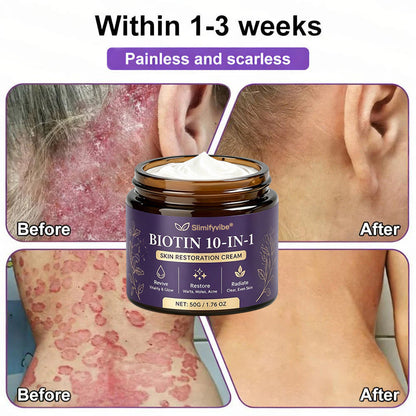 Made and Shipped from USA ✨SLIMIFYVIBE® Biotin 10-in-1 Skin Restoration Cream 🍀