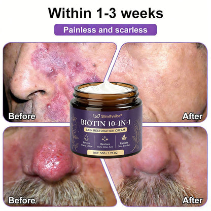 Made and Shipped from USA ✨SLIMIFYVIBE® Biotin 10-in-1 Skin Restoration Cream 🍀